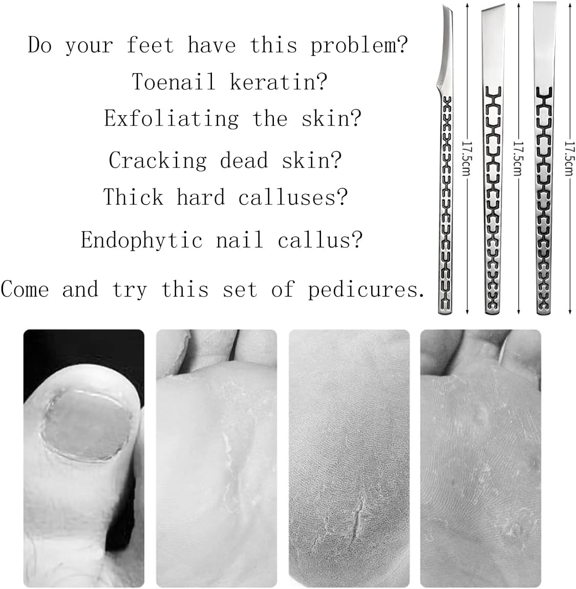 3PCS Stainless Steel Ingrown Toenail Pedicure Knife Set, Professional Pedicure Tool Peeling Knife for Nail Corn Callus(with Whetstone)