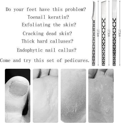 3PCS Stainless Steel Ingrown Toenail Pedicure Knife Set, Professional Pedicure Tool Peeling Knife for Nail Corn Callus(with Whetstone)