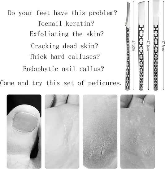 3PCS Stainless Steel Ingrown Toenail Pedicure Knife Set, Professional Pedicure Tool Peeling Knife for Nail Corn Callus(with Whetstone)