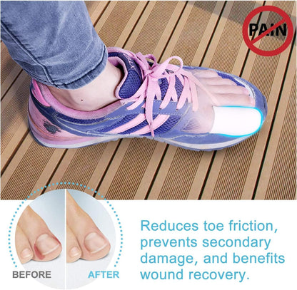 Silicone Toe Protectors - 12 Pack Gel Toe Sleeves Toe Protectors - Toe Caps with Aloe Vera Essential Oils - Toe Cushions for Pain Relief, Toe Protection for Corns, Calluses (8L + 4S)