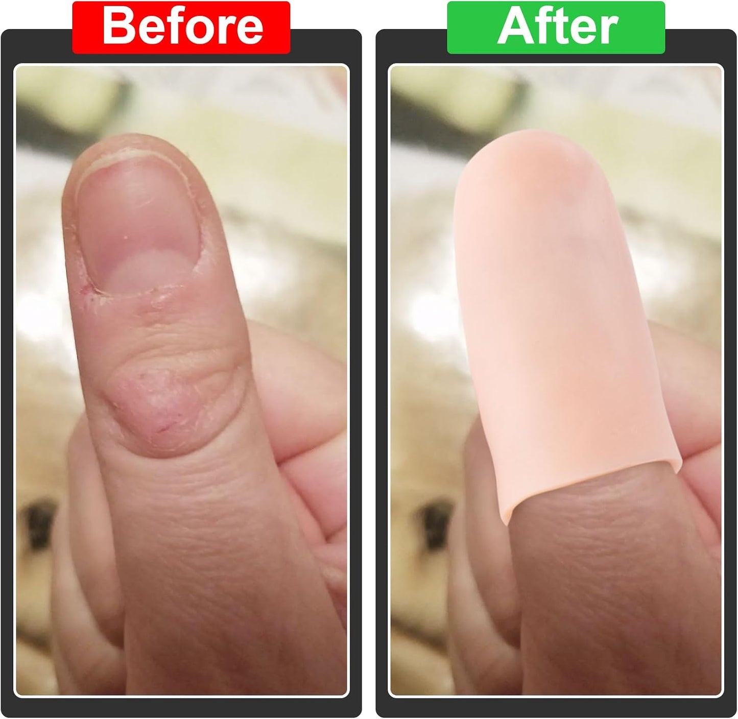 10pcs Gel Finger Cots, Silicone Finger Covers, Thumb Protector Finger Support Protector Caps Gloves